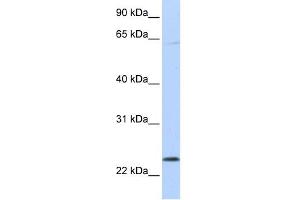WB Suggested Anti-CHAC1 Antibody Titration: 0. (CHAC1 anticorps  (C-Term))
