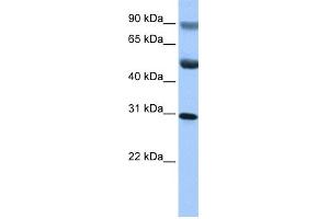 WB Suggested Anti-C17orf39 Antibody Titration: 0. (GID4 anticorps  (C-Term))