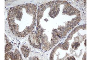 Image no. 1 for anti-Palmitoyl-Protein Thioesterase 1 (PPT1) (AA 100-306) antibody (ABIN1490801)