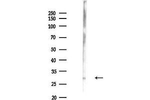 anti-CCAAT/enhancer Binding Protein (C/EBP), alpha (CEBPA) (N-Term) antibody