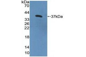 Detection of Recombinant IL8Rb, Human using Polyclonal Antibody to Interleukin 8 Receptor Beta (IL8Rb) (CXCR2 anticorps  (AA 1-57))