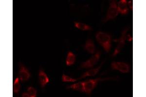 ABIN6274834 staining 293 by IF/ICC.