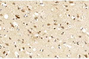 Immunohistochemical analysis of paraffin-embedded Human brain section using LINGO-1(LRRN6A)- (C-term) Antibody (ABIN651289 and ABIN2840172). (LINGO1 anticorps  (C-Term))