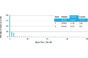 anti-Kv Channel Interacting Protein 2 (KCNIP2) antibody