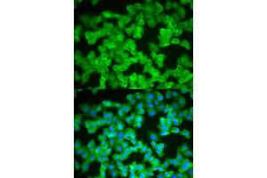 Immunofluorescence (IF) image for anti-S100 Calcium Binding Protein A12 (S100A12) antibody (ABIN1876516) (S100A12 anticorps)