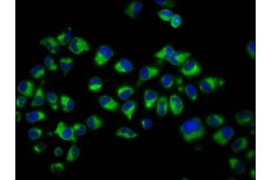 Immunofluorescence staining of Hela cells with ABIN7149086 at 1:200, counter-stained with DAPI. (Cytochrome B Reductase 1 anticorps  (AA 220-286))