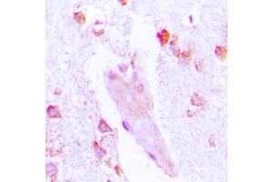 Immunohistochemical analysis of Carbonic Anhydrase 1 staining in human brain formalin fixed paraffin embedded tissue section.