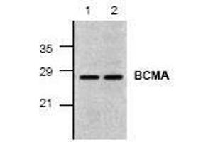 Image no. 1 for anti-Tumor Necrosis Factor Receptor Superfamily, Member 17 (TNFRSF17) (C-Term) antibody (ABIN127204) (BCMA anticorps  (C-Term))