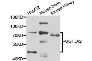 Western blot analysis of extracts of various cell lines, using μgT3A2 antibody (ABIN5975308) at 1/1000 dilution. (UGT3A2 anticorps)