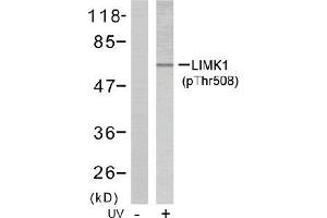 Image no. 2 for anti-LIM Domain Kinase 1 (LIMK1) (pThr508) antibody (ABIN196830) (LIM Domain Kinase 1 anticorps  (pThr508))