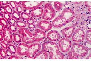 Human Kidney: Formalin-Fixed, Paraffin-Embedded (FFPE) (APOA2 anticorps)