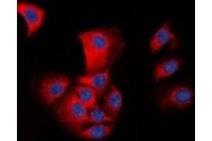 Immunofluorescent analysis of ASC staining in HepG2 cells. (STS anticorps  (N-Term))