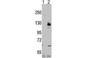 Western blot analysis of TRPM8 antibody and 293 cell lysate either nontransfected (Lane 1) or transiently transfected with the TRPM8 gene (2). (TRPM8 anticorps  (AA 926-956))