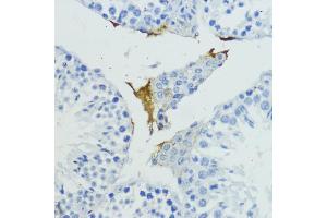 Immunohistochemistry of paraffin-embedded mouse testis using KLKB1 antibody (ABIN6129406, ABIN6142965, ABIN6142967 and ABIN6217272) at dilution of 1:200 (40x lens). (KLKB1 anticorps  (AA 20-300))