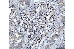 IHC analysis of PU.
