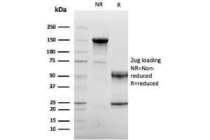 SDS-PAGE Analysis Purified Endoglin / CD105 Mouse Monoclonal Antibody (ENG/3269).