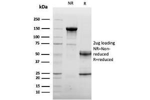 SDS-PAGE Analysis Purified Endoglin / CD105 Mouse Monoclonal Antibody (ENG/3269). (Endoglin anticorps  (AA 74-251))