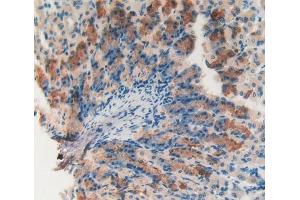 IHC-P analysis of Mouse Stomach Tissue, with DAB staining. (Catalase anticorps  (AA 32-157))