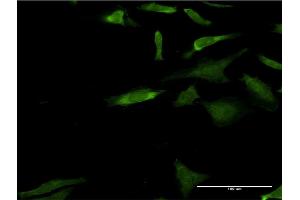 Immunofluorescence of monoclonal antibody to MAPK3 on HeLa cell. (ERK1 anticorps  (AA 279-379))