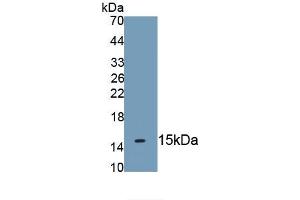 Detection of Recombinant KRT2, Human using Monoclonal Antibody to Keratin 2 (CK2)