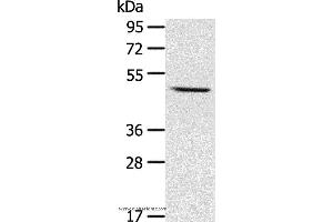 Western blot analysis of Mouse liver tissue, using CYP1A1 Polyclonal Antibody at dilution of 1:400 (CYP1A1 anticorps)