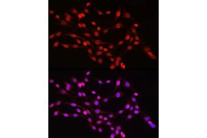 Immunofluorescence analysis of PC-12 cells using Lamin B1 Rabbit pAb (ABIN3015697, ABIN3015698, ABIN3015699, ABIN1680700 and ABIN6219049) at dilution of 1:150 (40x lens). (Lamin B1 anticorps  (AA 397-586))