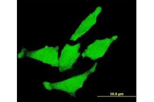 Image no. 1 for anti-Receptor tyrosine-protein kinase erbB-2 (ErbB2/Her2) (AA 22-122) antibody (ABIN599374) (ErbB2/Her2 anticorps  (AA 22-122))
