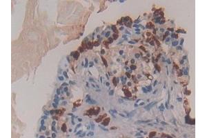 Detection of MEAI in Human Pancreas Tissue using Polyclonal Antibody to Menin (MEAI)