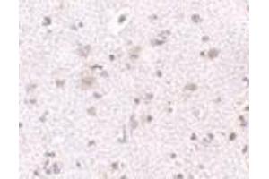 Immunohistochemistry of BRCC45 in human brain tissue with BRCC45 antibody at 2.