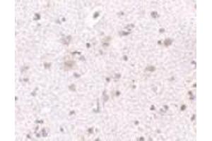 Immunohistochemistry of BRCC45 in human brain tissue with BRCC45 antibody at 2. (BRE anticorps  (N-Term))