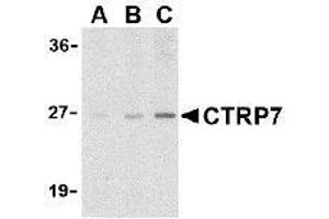 Western blot analysis of CTRP7 in 3T3 cell lysate with AP30259PU-N CTRP7 antibody at (A) 1, (B) 2, and (C) 4 μg/ml. (CTRP7 anticorps  (N-Term))