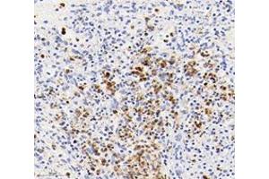 Immunohistochemistry analysis of paraffin-embedded human spleen using,S100A12 (ABIN7075493) at dilution of 1: 4000 (S100A12 anticorps)