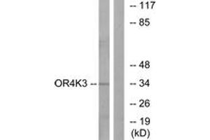 Western blot analysis of extracts from Jurkat cells, using OR4K3 Antibody.