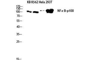 Western Blot (WB) analysis of KB K562 HeLa 293T lysis using NFkappaB-p100 antibody. (NFKB2 anticorps  (Thr160))
