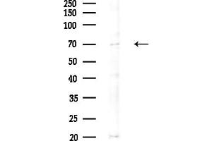 anti-2'-5' Oligoadenylate Synthetase 2 (OAS2) (C-Term) antibody