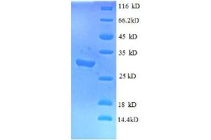Interferon-Induced Transmembrane Protein 1 (IFITM1) (AA 1-36) protein (GST tag)