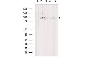 Western blot analysis of extracts from various samples, using PYGL antibody. (PYGL anticorps  (Internal Region))