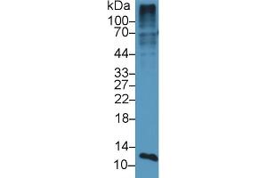 Detection of S100A4 in Mouse Placenta lysate using Polyclonal Antibody to S100 Calcium Binding Protein A4 (S100A4) (s100a4 anticorps  (AA 1-101))
