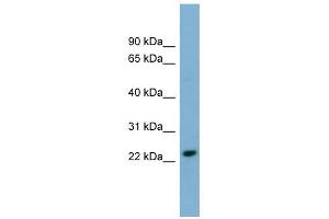 KLRC3 antibody used at 1 ug/ml to detect target protein. (KLRC3 anticorps  (N-Term))