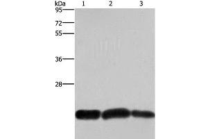 Western Blot analysis of A375 and Raji cell, Human fetal brain tissue using CBX3 Polyclonal Antibody at dilution of 1:600 (CBX3 anticorps)
