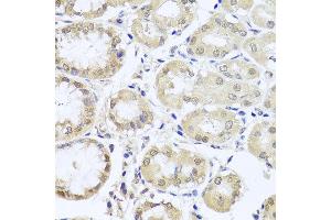Immunohistochemistry of paraffin-embedded human stomach using CGB7 antibody at dilution of 1:100 (x40 lens). (CGB7 anticorps)
