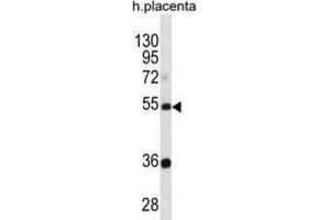 Western Blotting (WB) image for anti-Tektin 3 (TEKT3) antibody (ABIN3000961) (Tektin 3 anticorps)