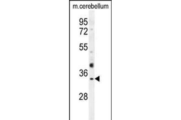 OR51I1 antibody  (C-Term)