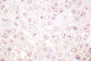 Image no. 1 for anti-K(lysine) Acetyltransferase 2B (KAT2B) antibody (ABIN271904)