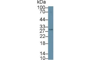 Western Blot; Sample: Mouse Serum; Primary Ab: 2µg/ml Rabbit Anti-Mouse CLEC4L Antibody Second Ab: 0.