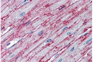 Human Heart (formalin-fixed, paraffin-embedded) stained with PNPT1 antibody ABIN462230 followed by biotinylated goat anti-rabbit IgG secondary antibody ABIN481713, alkaline phosphatase-streptavidin and chromogen.