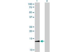 Western Blot analysis of RPA3 expression in transfected 293T cell line by RPA3 monoclonal antibody (M01), clone 1F4.