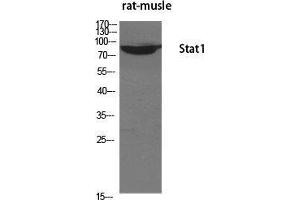 Western Blot (WB) analysis of specific cells using Stat1 Polyclonal Antibody. (STAT1 anticorps  (Tyr1217))