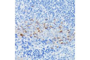 Immunohistochemistry of paraffin-embedded mouse spleen using CD225/IFITM1 antibody (ABIN1680390, ABIN3018715, ABIN3018716 and ABIN6220553) at dilution of 1:100 (40x lens). (IFITM1 anticorps  (C-Term))