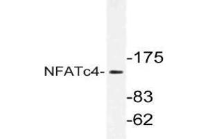 Western blot analysis of NFATc4 Antibody NFATc4 in extracts from Jurkat cells. (NFATC4 anticorps)